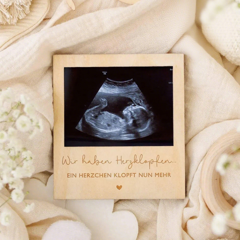 Ultrasound Pregnancy Announcem - огляд і ціна Photo Booth Frame